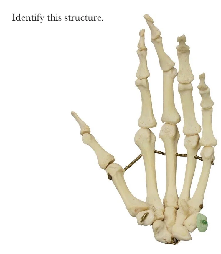 pisiform_bone_identify.JPG