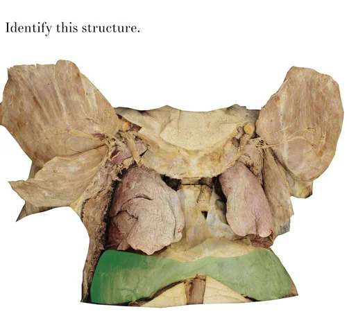 diaphragm_identify.jpg