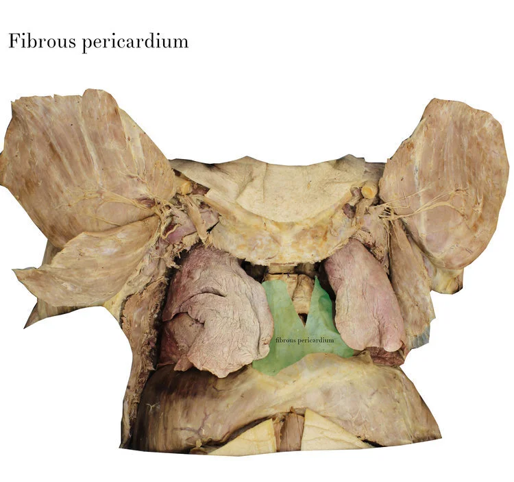 fibrous_pericardium_labelled.jpg