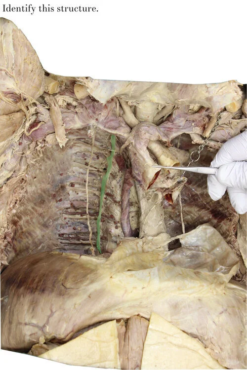 sympathetic_trunk_(chain)_identify.jpg