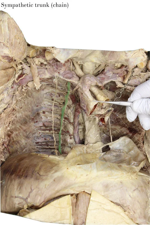 sympathetic_trunk_(chain)_labelled.jpg