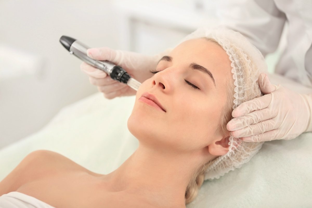 micro-needling-4.jpg