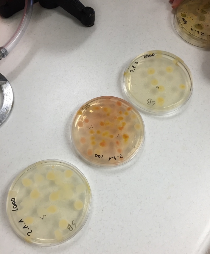 Plastic Petri dishes containing the Sabouraud agar (solid medium) used to grow fungi colonies