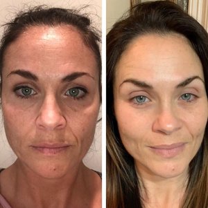 “As women we spend a fortune on facials, botox, and treatments, so why not add something to our regime that costs less than all of those, but delivers results? This is what 5 months on The Gel looks like!” Image: NewULife