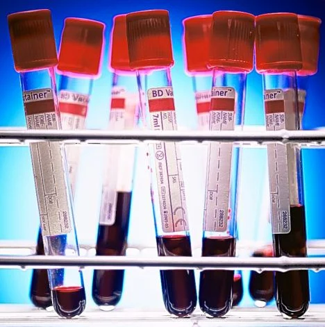 The more blood work, the better