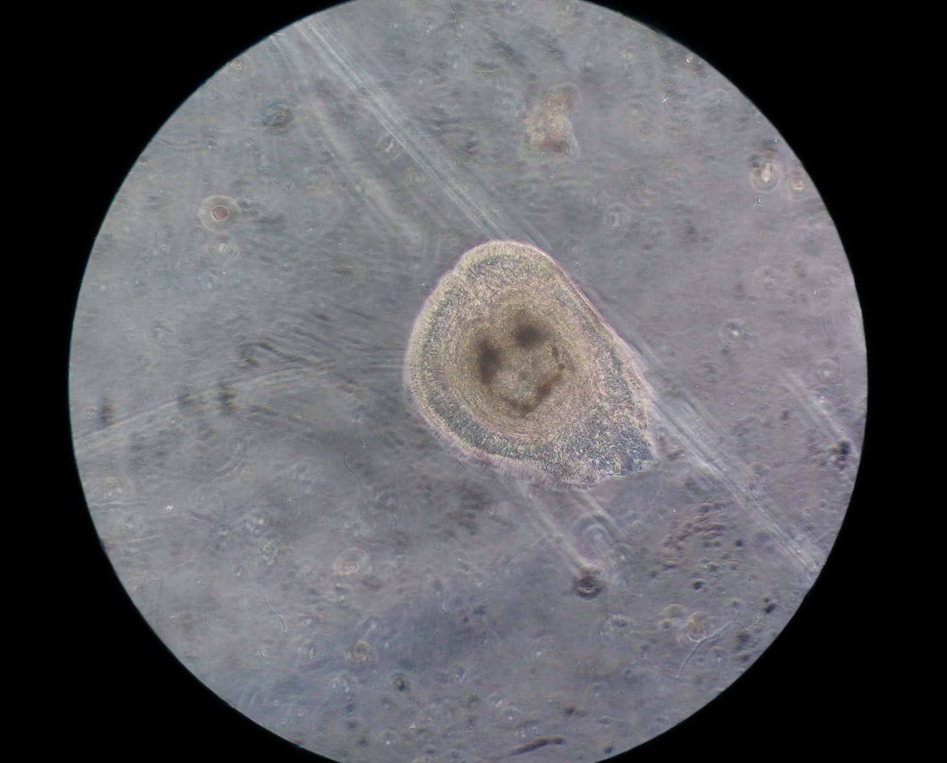Taken by shakily holding my camera phone up to the viewing lens, at a total of 100x magnification.