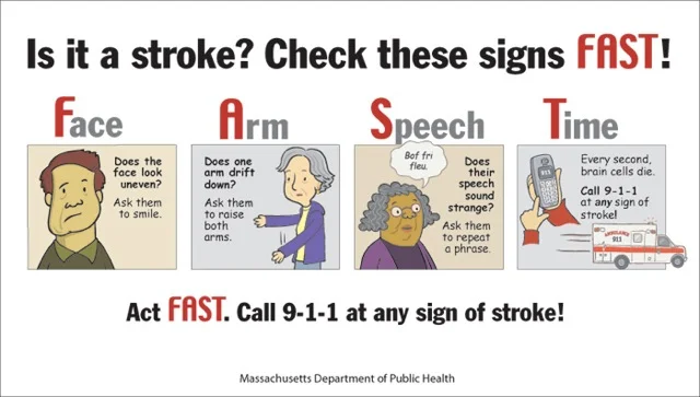FAST-Stroke-model.jpg