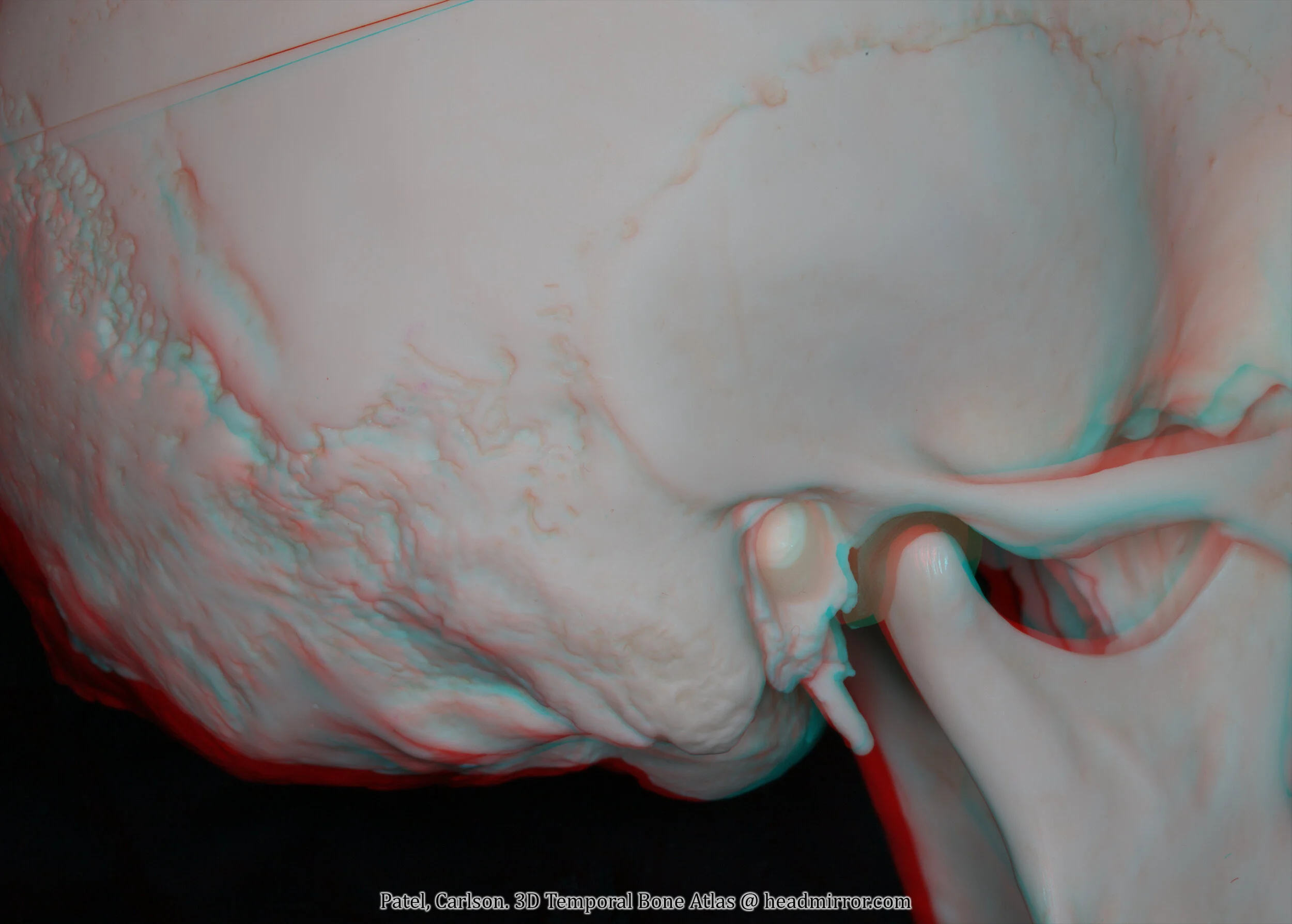 Temporal Head