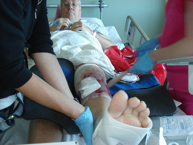 Total Knee Replacements Common After Automobile Accidents