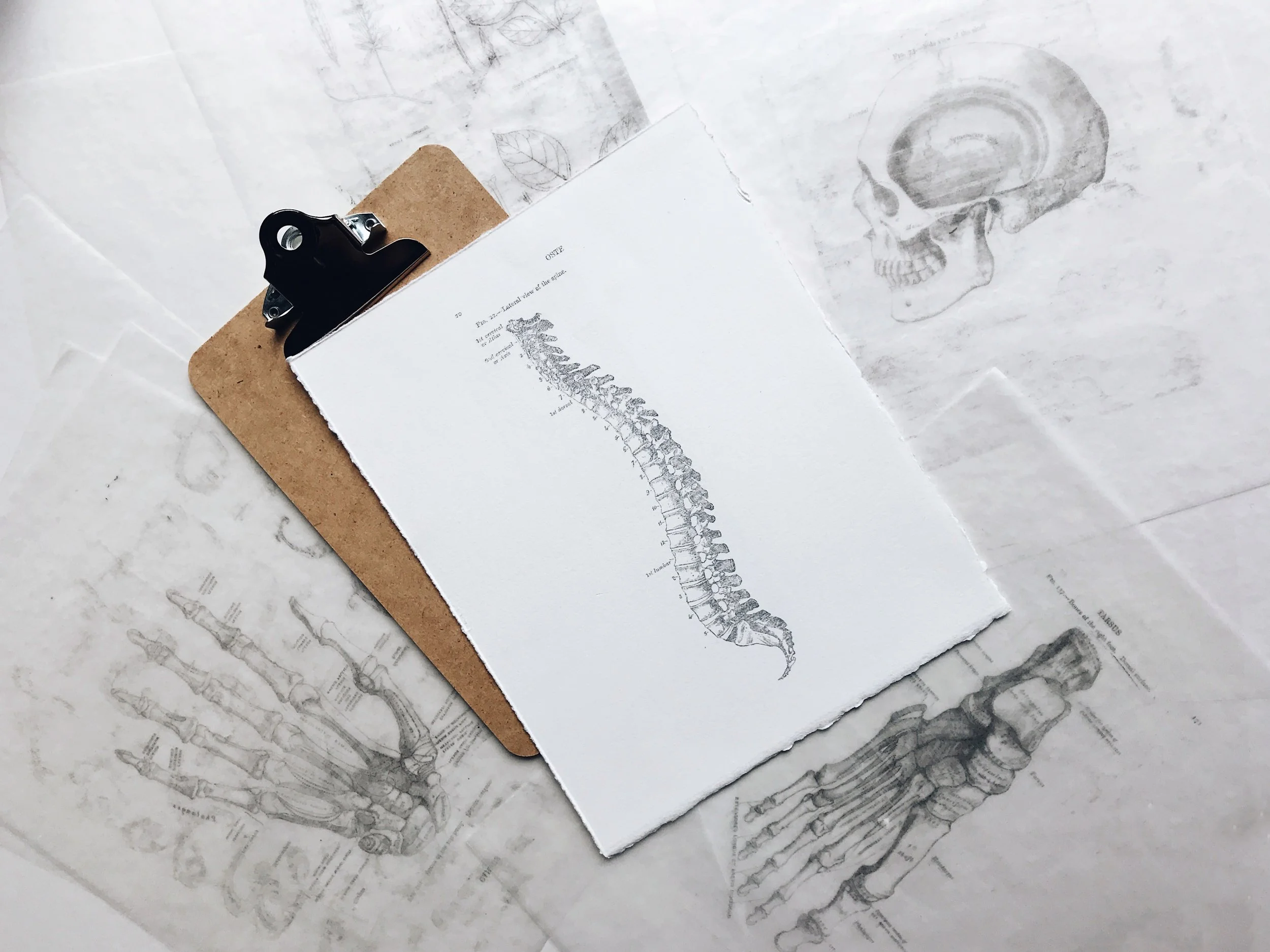 Michigan spine injury diagram