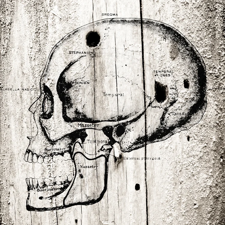 A Hole in the Head