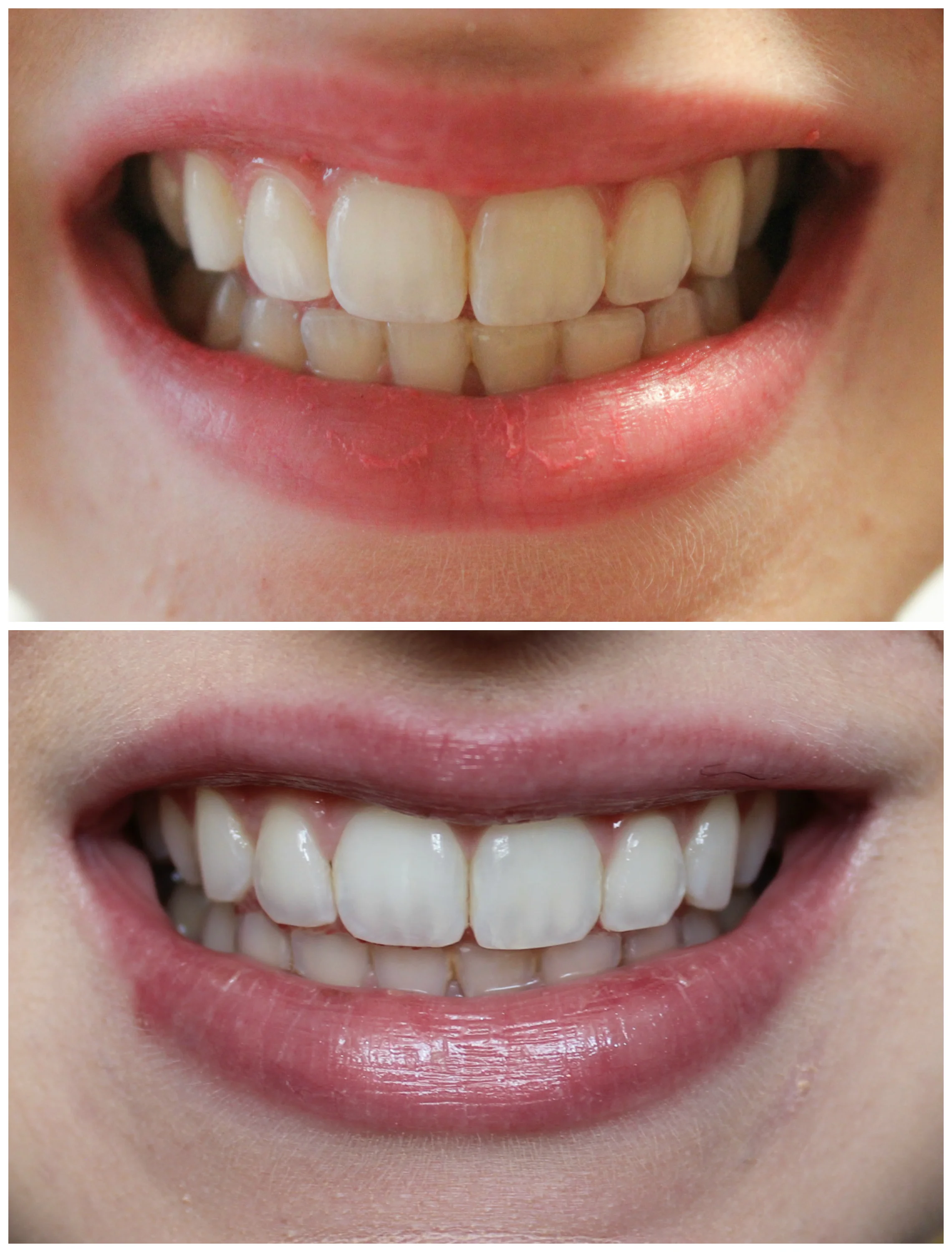 My Before and After!