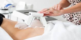 different cryolipolysis handles