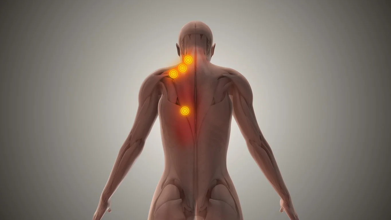 Trigger Point Massage