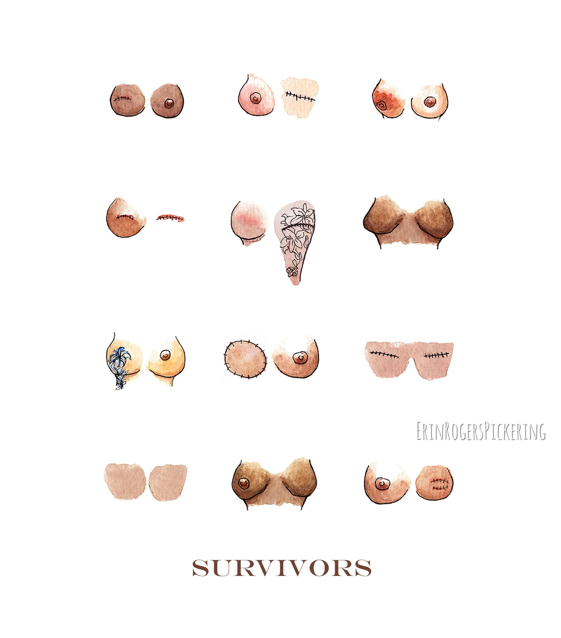Survivors.breasts_Pickering.jpg