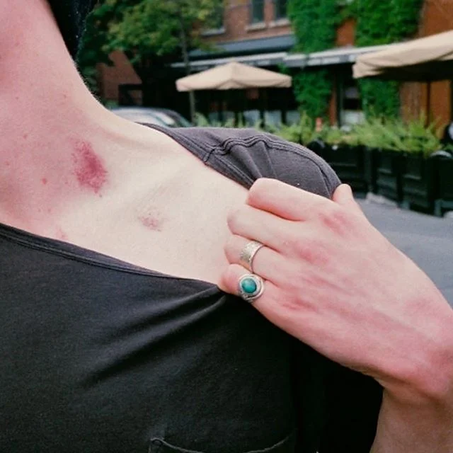 dreamed last night that a guy gave me a hickey on my chest near my shoulder. He was really into it and it didn&rsquo;t hurt and I was like dang this guy is obsessed with me.