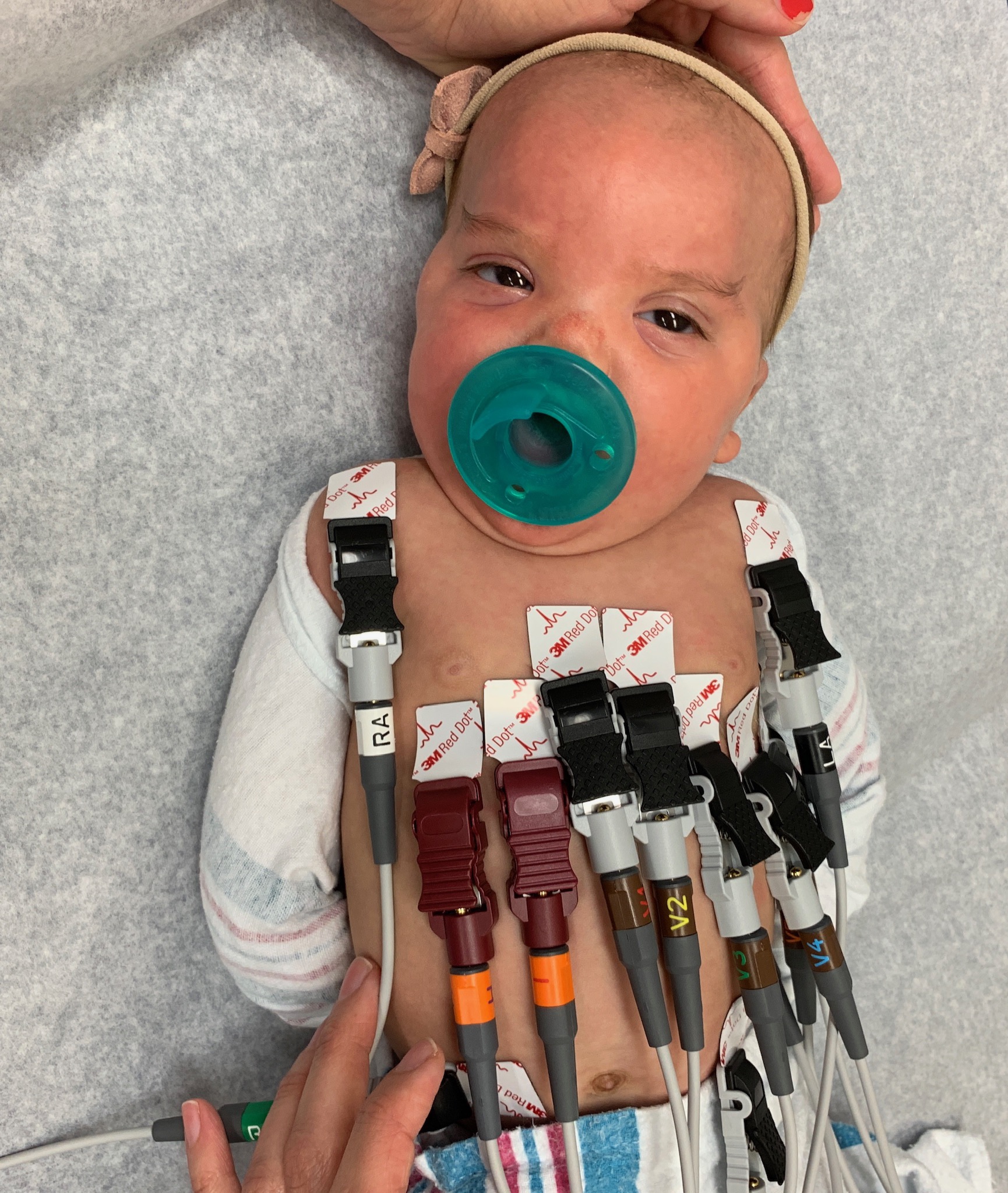 Our other brave little one at her monthly cardiology appointment.