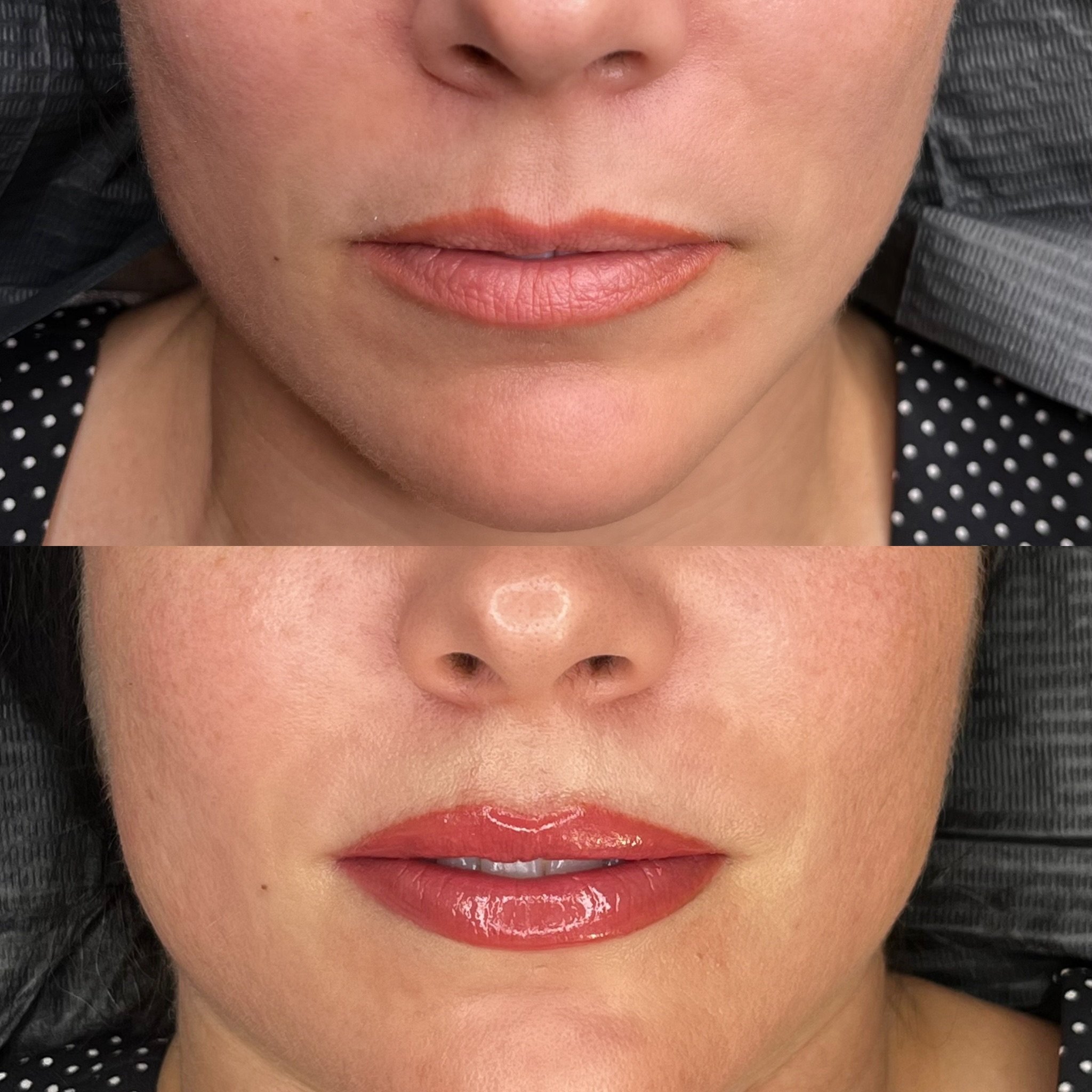 Lip Blush Before and After