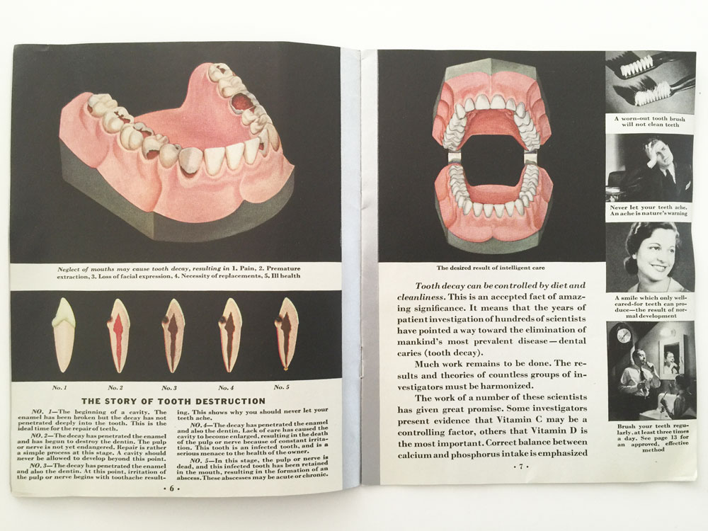 The Story of Tooth Destruction