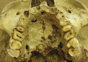 Egyptian teeth