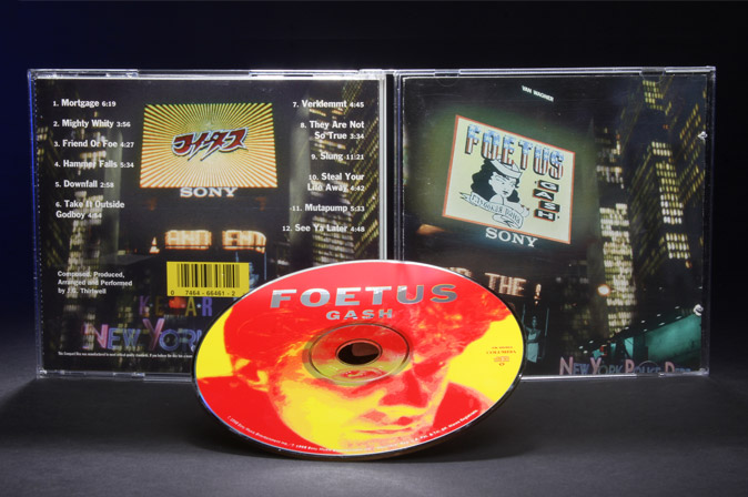 Foetus