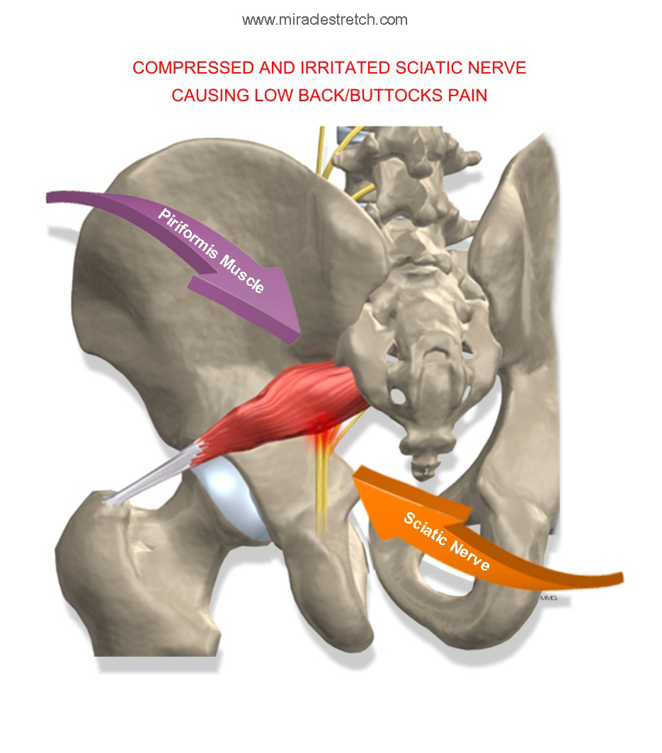 Anatomy of Piriformis Muscle and Sciatic Nerve