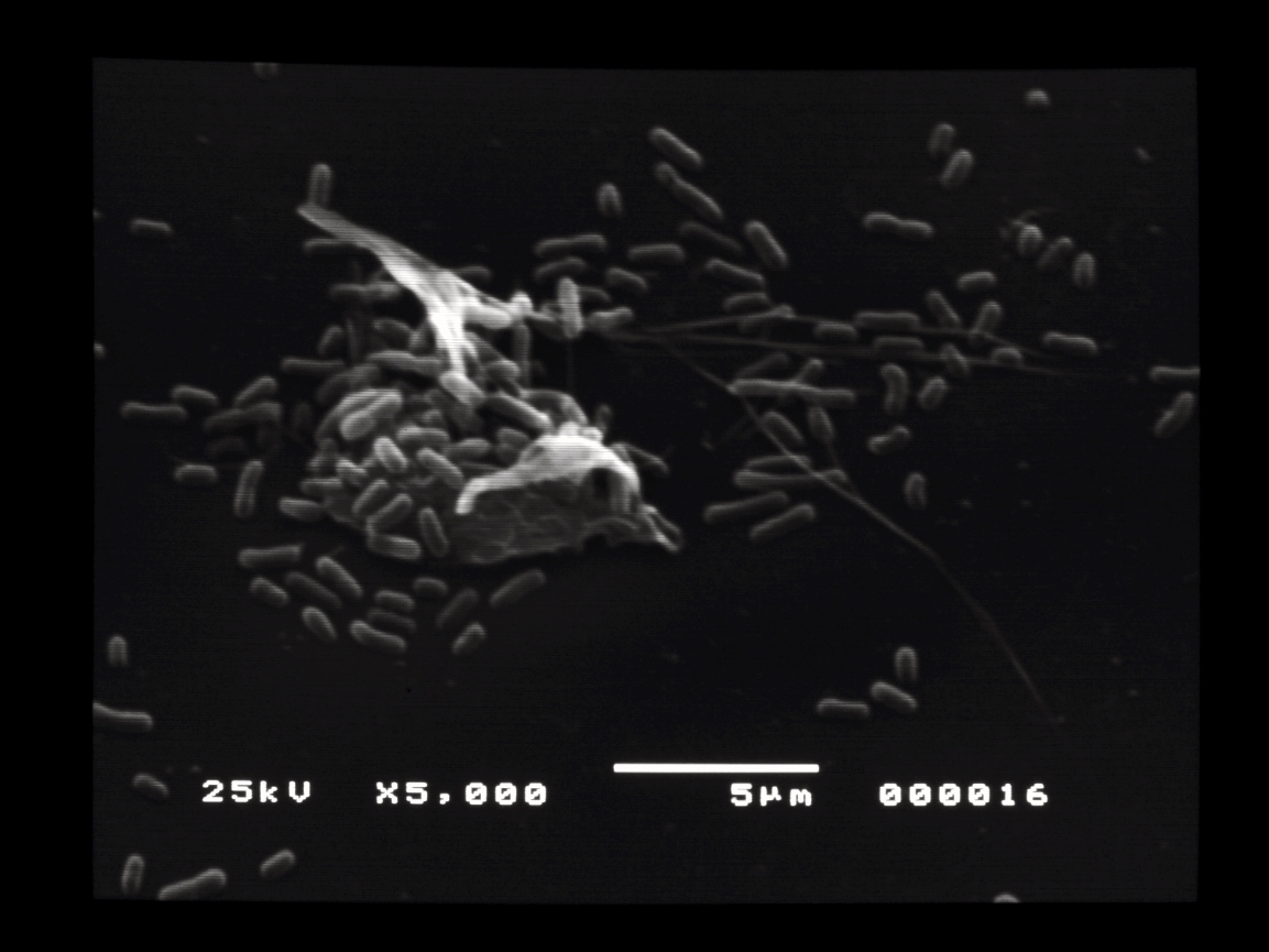 SEM of Chryseobacterium biofilm by Sarah DiDomenico