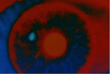 26. Chapter 31 - 2001 Bowman Eye
