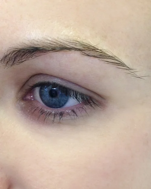 Example #2 Before