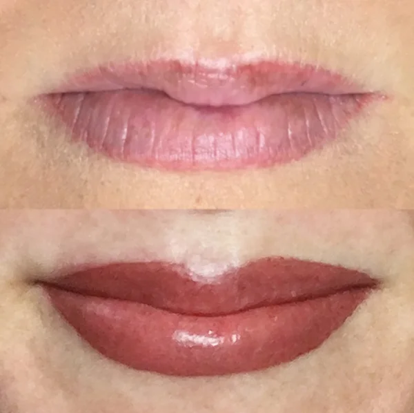 Example #2 Before & After