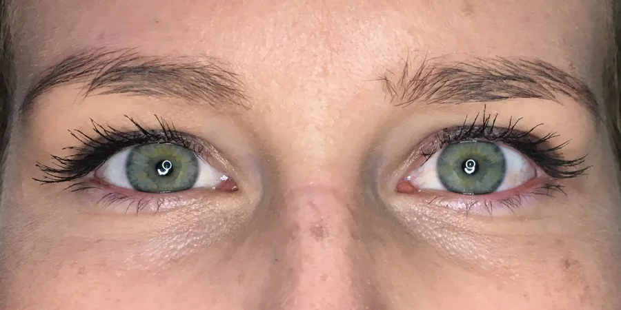 Example #3 - Before