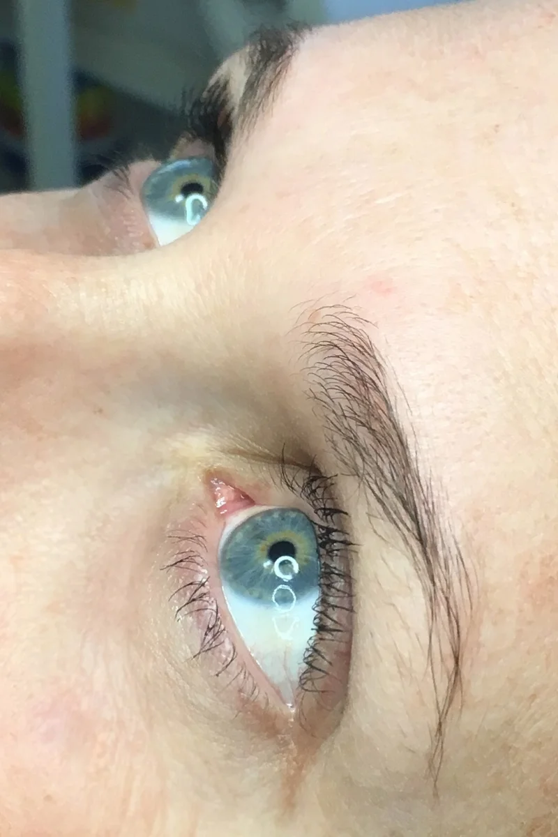 Example #4 - Before