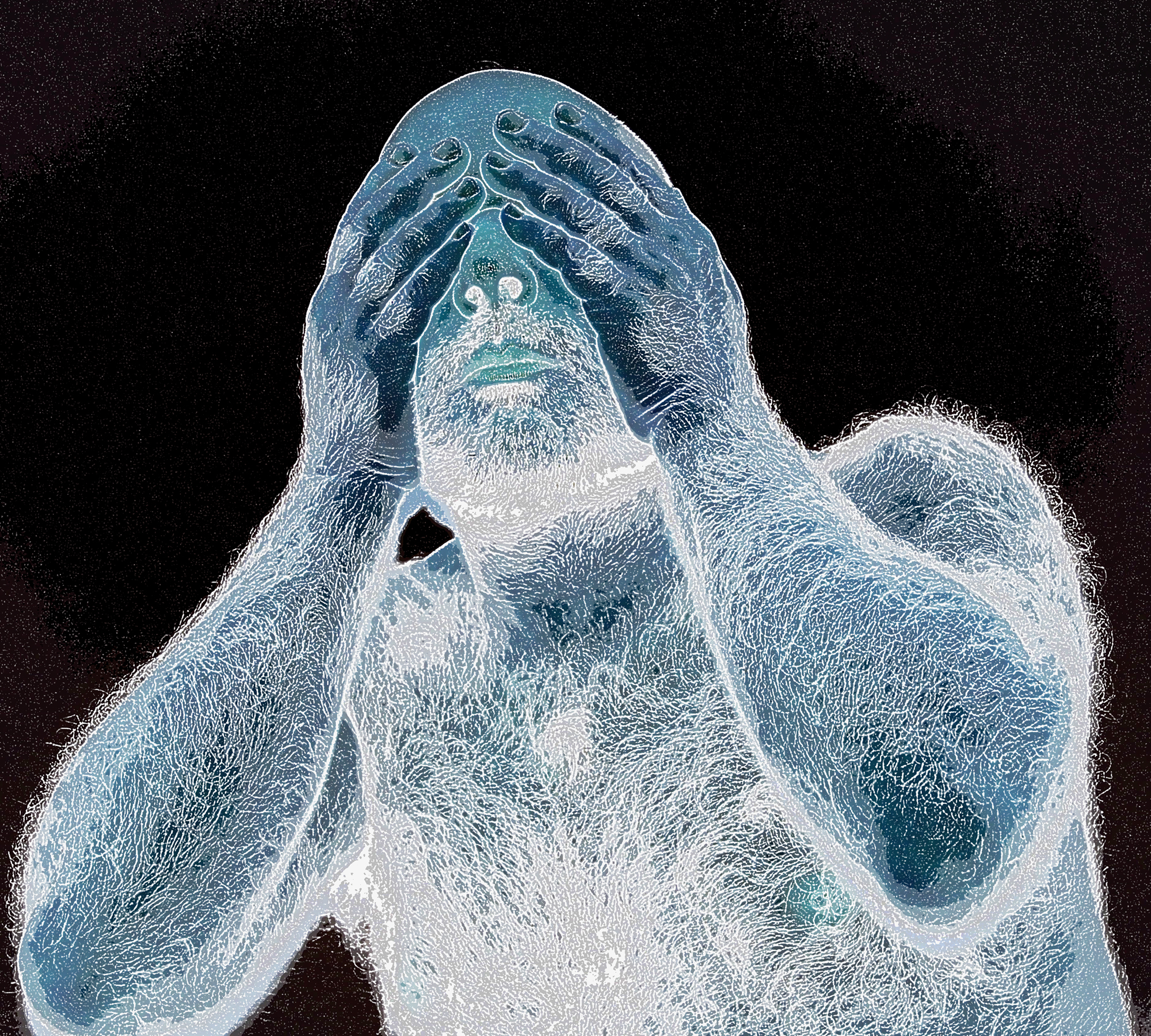 3. Blinded .jpg