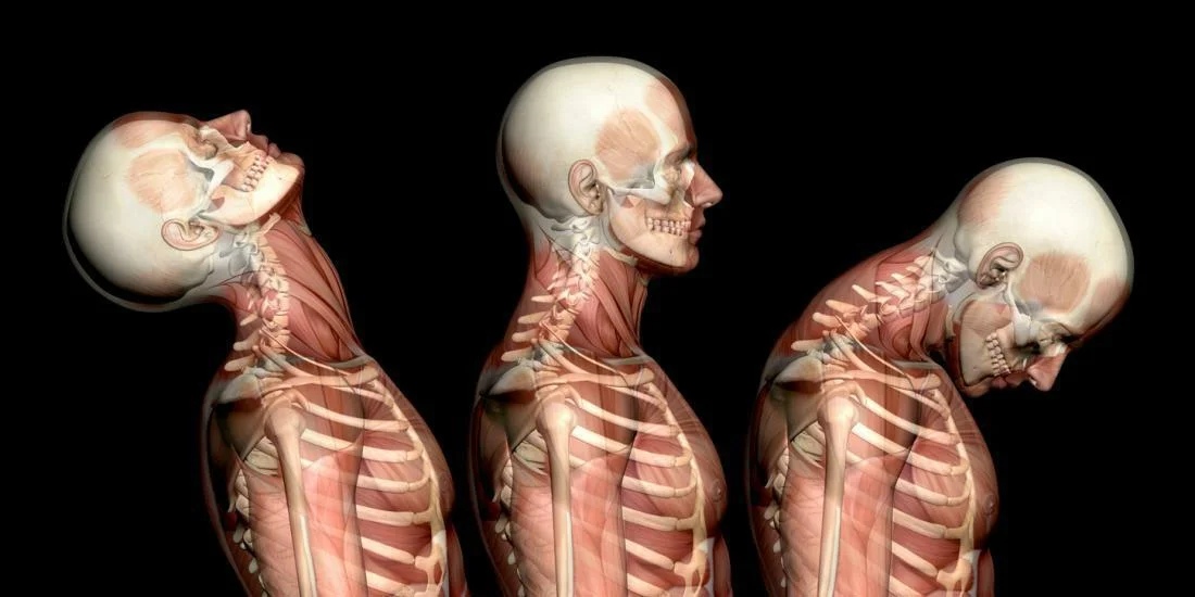 UNDERSTANDING NECK PAIN AND STIFFNESS