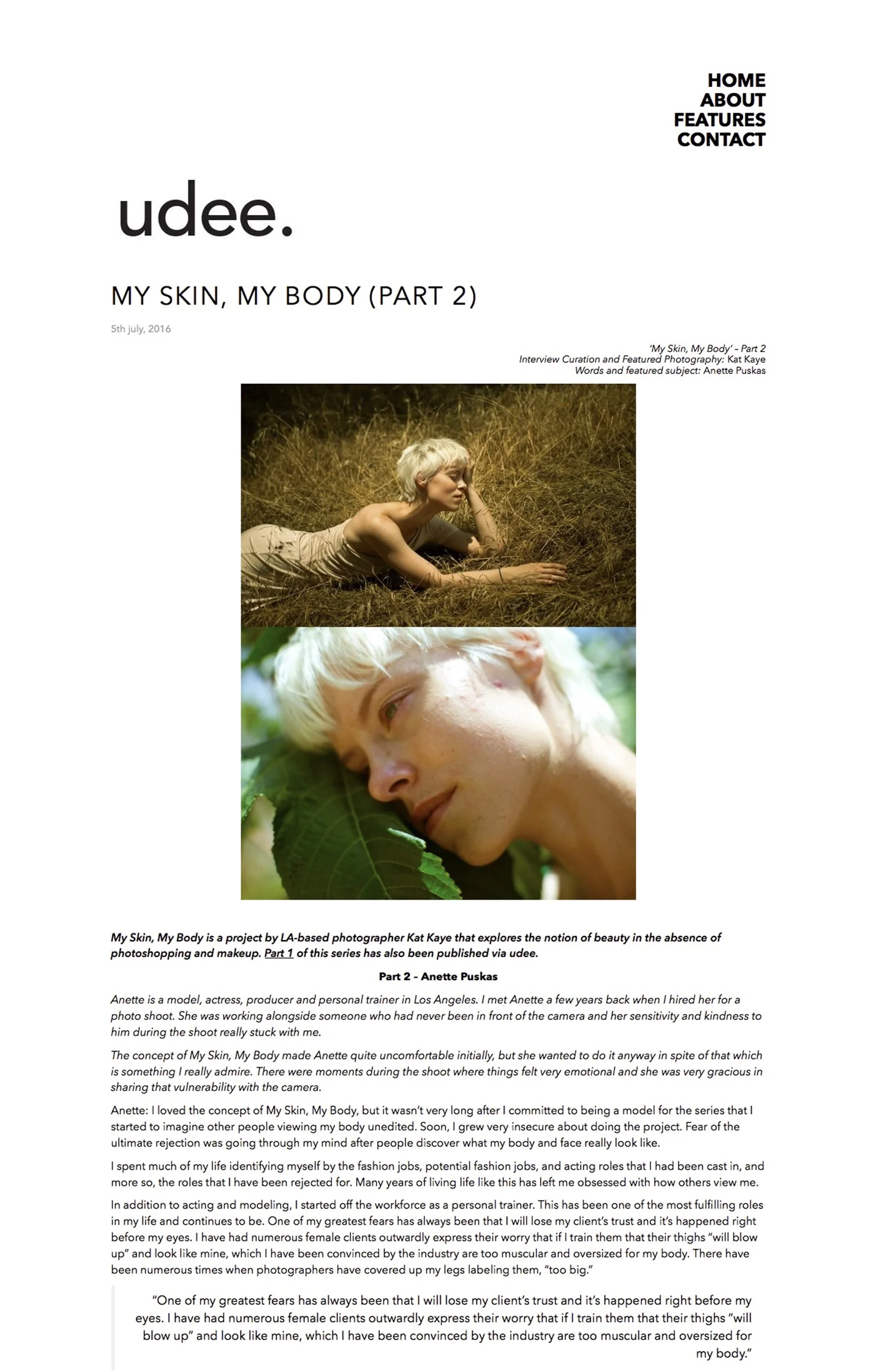 "My Skin, My Body" featured on Udee (part 2)