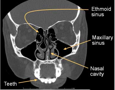 (NOT my scan) Image from: radiologyinfo.org