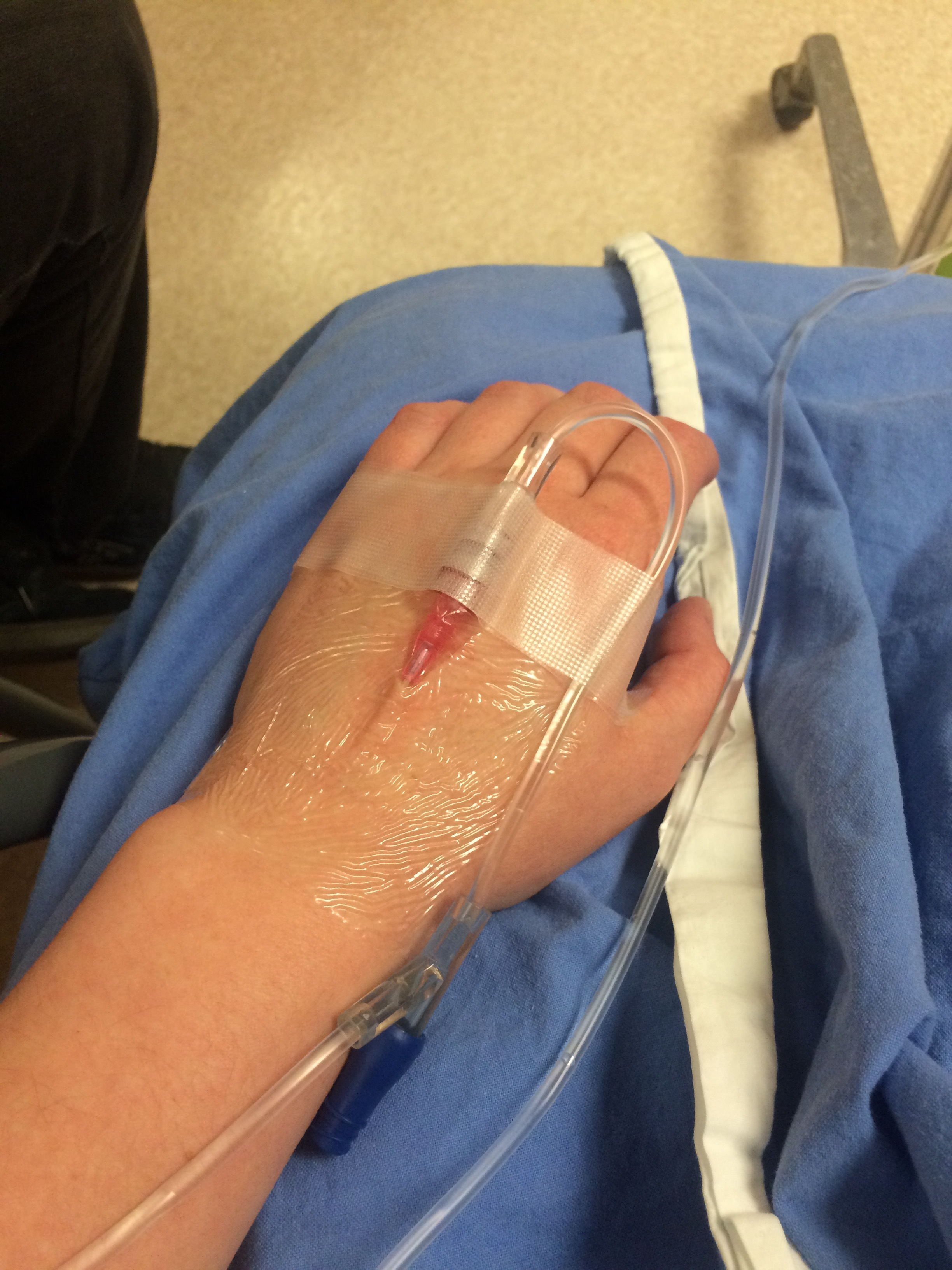 After finally getting my IV in place, I got my baggy of fluids, after fasting for 12 hours, I needed hydration prior to surgery.