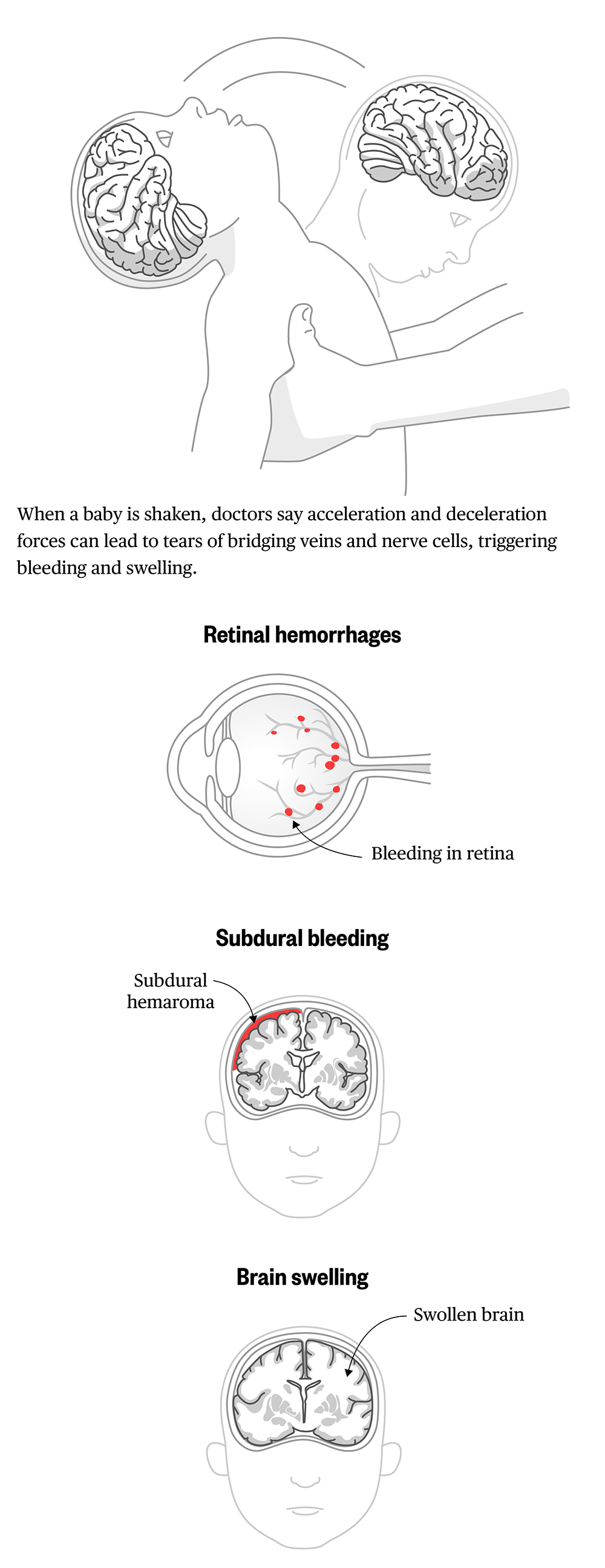 rem-nbc-news-do-no-harm-infographic.png