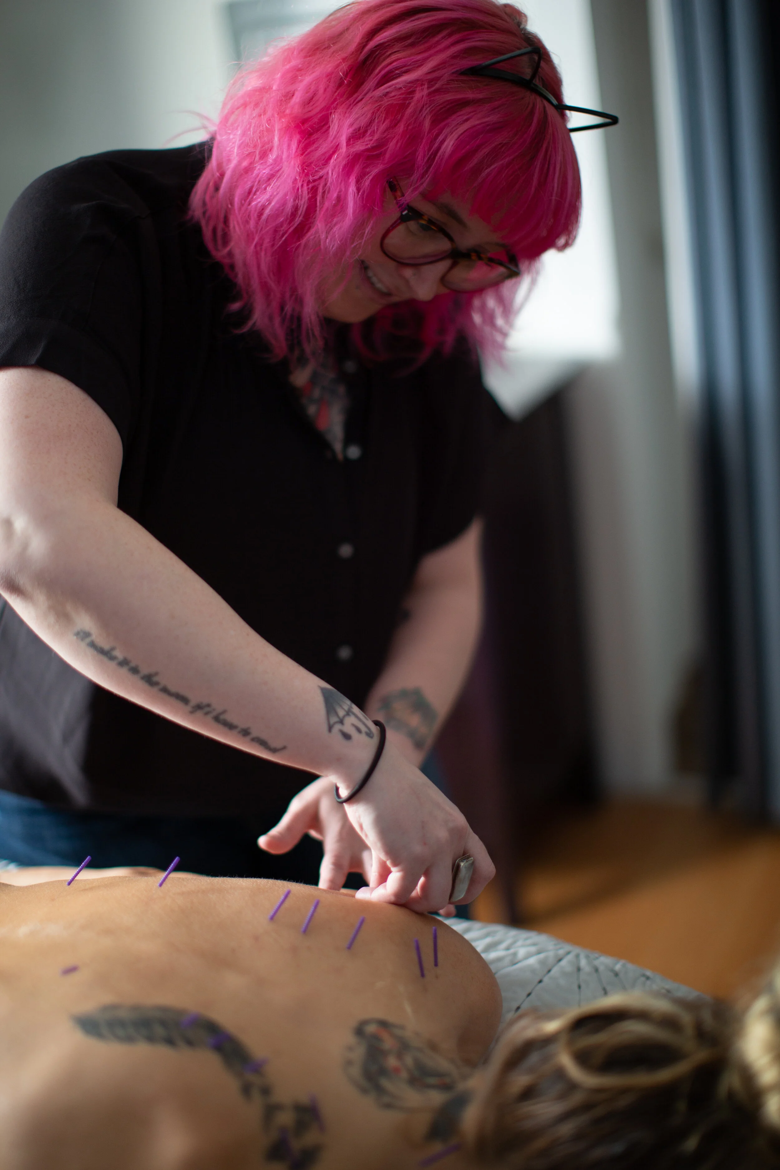 How does Acupuncture work?
