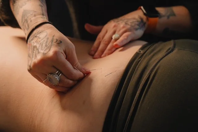 Kismet Acupuncture & Apothecary