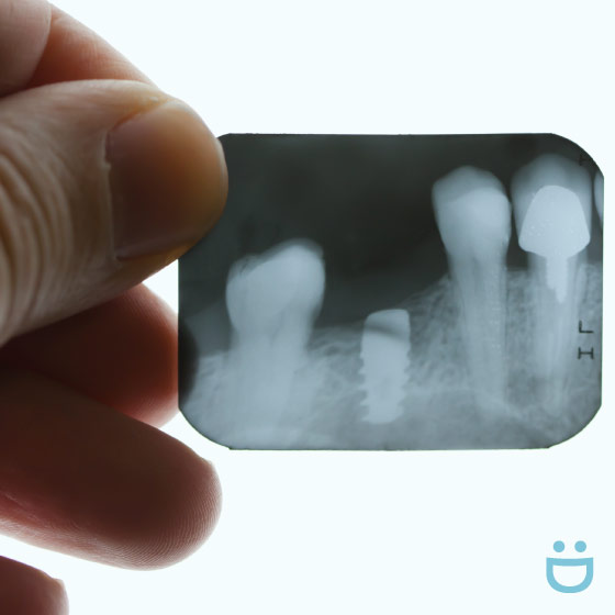 Frequently asked questions for Signature Dental