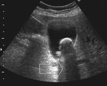 Physics of Ultrasound