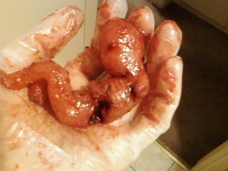 Fetus.jpg