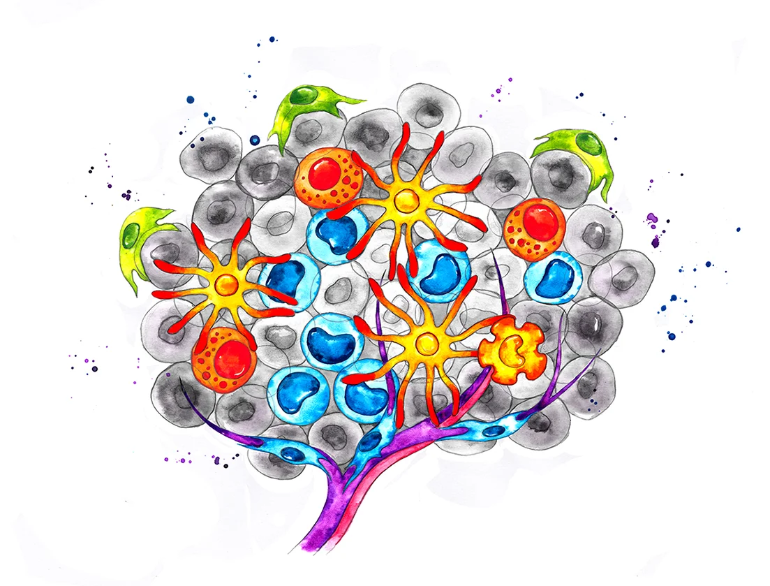Hot Tumor colour ed small.jpg