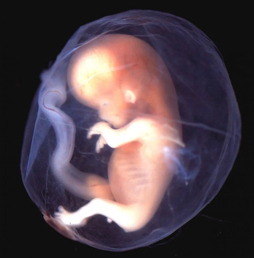 End Abortion Now: Educational Session
