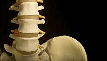 Pilates & Spinal Stenosis: