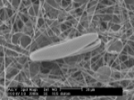 &nbsp;&nbsp;&nbsp;&nbsp;&nbsp;&nbsp;&nbsp;&nbsp;&nbsp;&nbsp;&nbsp;&nbsp;&nbsp;&nbsp;  Diatoms