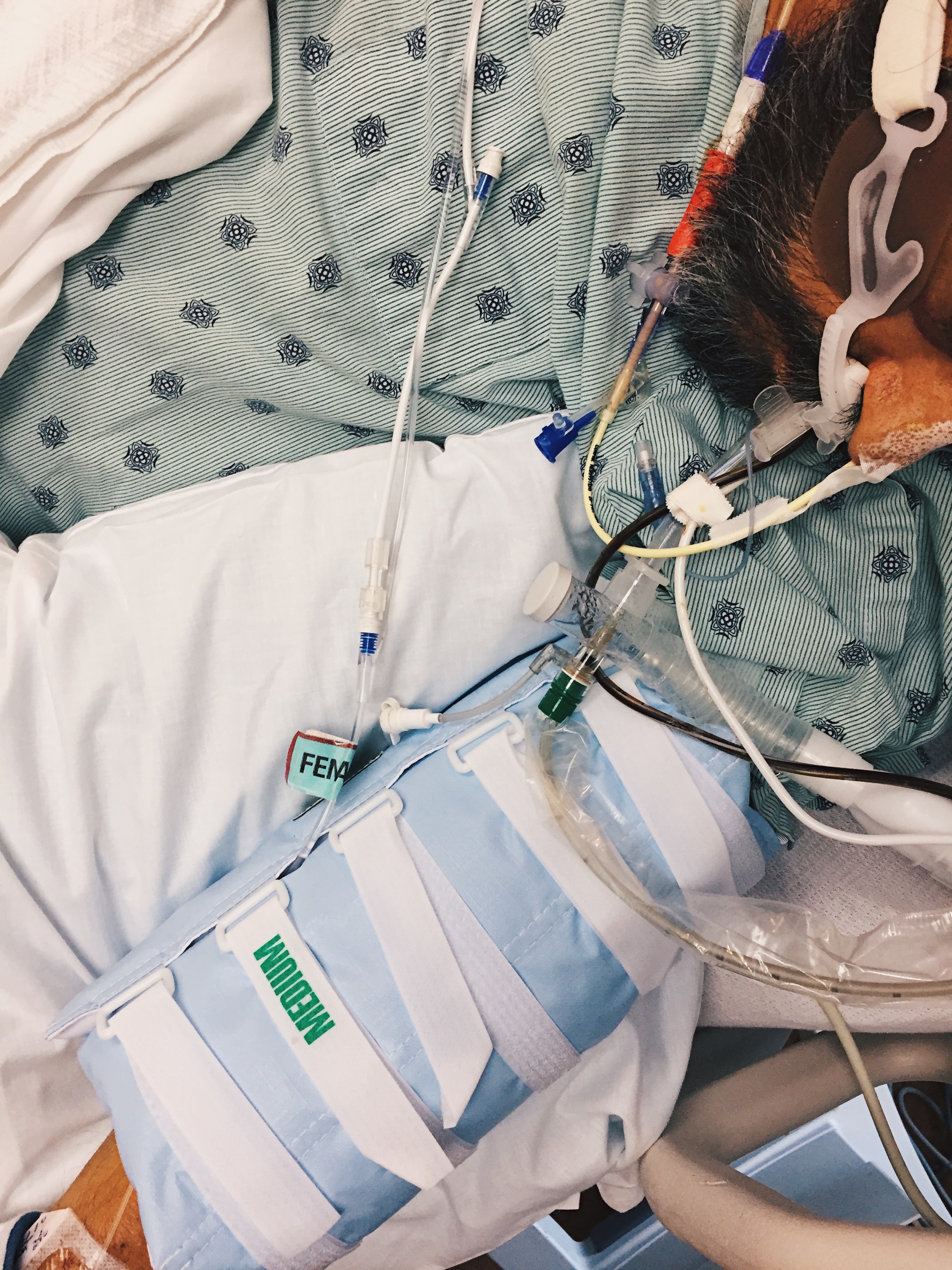 Dec. 28, 2016 — The day nurse called it a "stable day." It had been five days, four of which he had been on a breathing machine. High ammonia levels mixed with pain medication caused him to be in a coma-like state for almost a week. My father was not a man of minor responses; he always had something to say. Nurses said he was "in good spirits" when my father had arrived, and he was making jokes about leaving. That all changed within a couple of days. The day before, we had learned his stomach was processing foods incorrectly, and they had to give him a direct line to his small intestine.