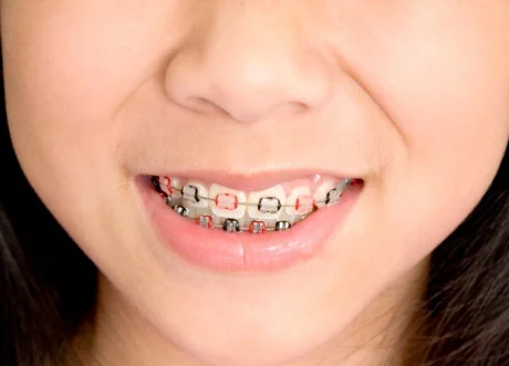 child_color_bands.jpg