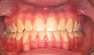 Case #2- Final